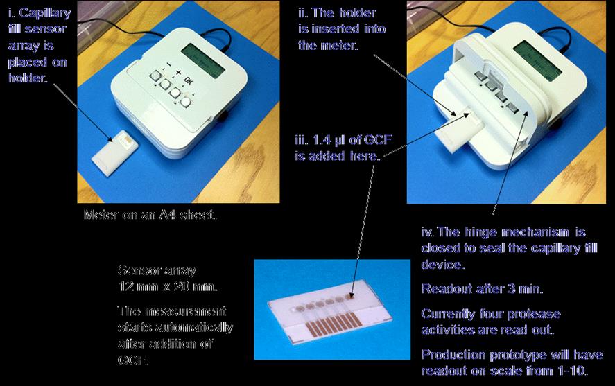 Figure 1: Meter used to detect protease activity in patients with periodontal disease