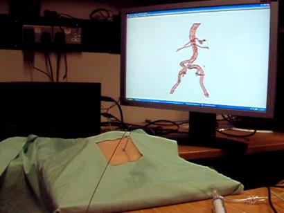 B. Interventional Radiology – Seldinger Technique Figure 1: Minimally Invasive Procedural Training Simulators