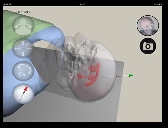 C. Neurosurgery – Vcath iPad App Figure 1: Minimally Invasive Procedural Training Simulators