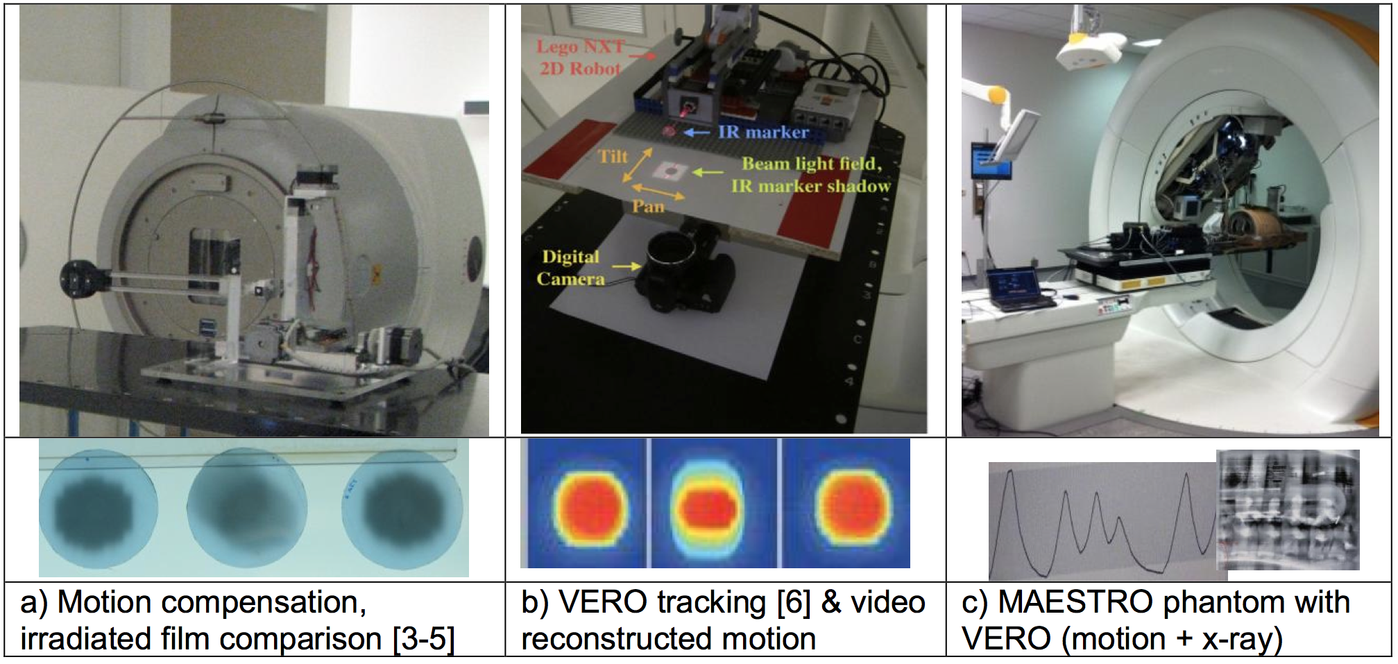 Figure 2: Evaluating the performance of motion tracking and compensation exploited by UZ
Brussels, Belgium and Brainlab, Germany to assess and subsequently deploy clinically the VERO.