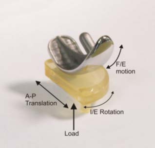 Knee joint (from Output 4)